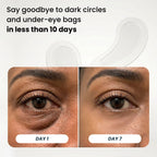Microneedle Patches | New Generation